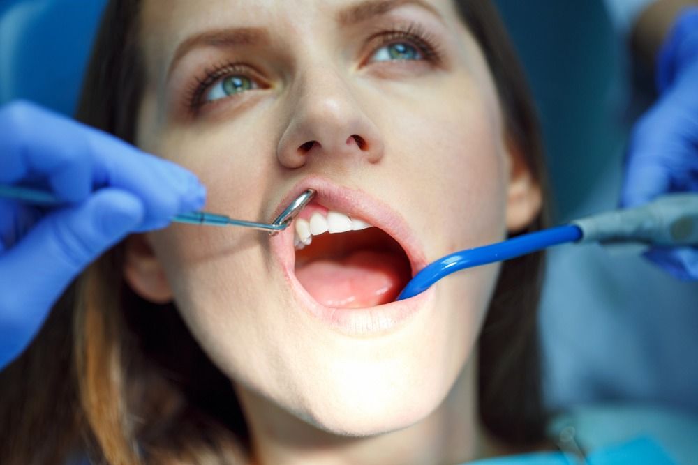 mujer con boca abierta revisada por utiles de dentista